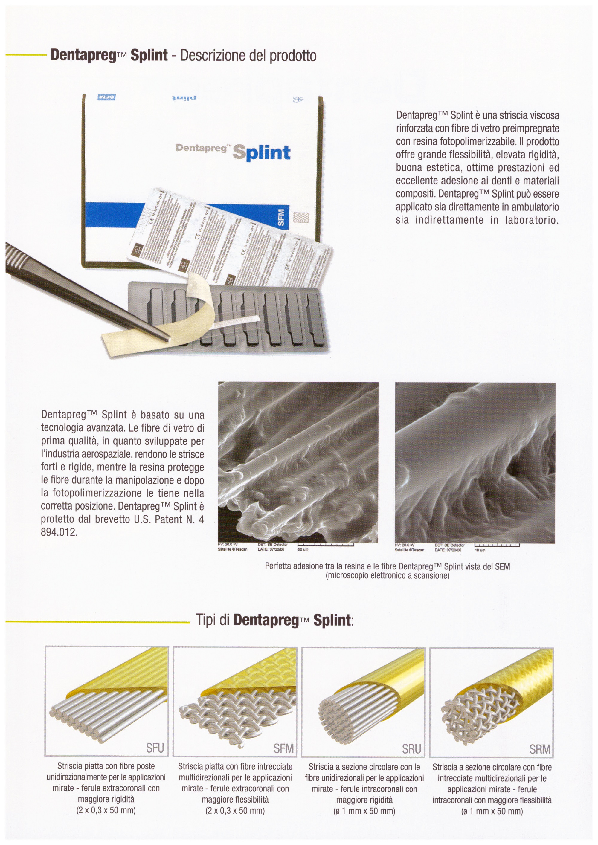 Dentapreg Splint 2