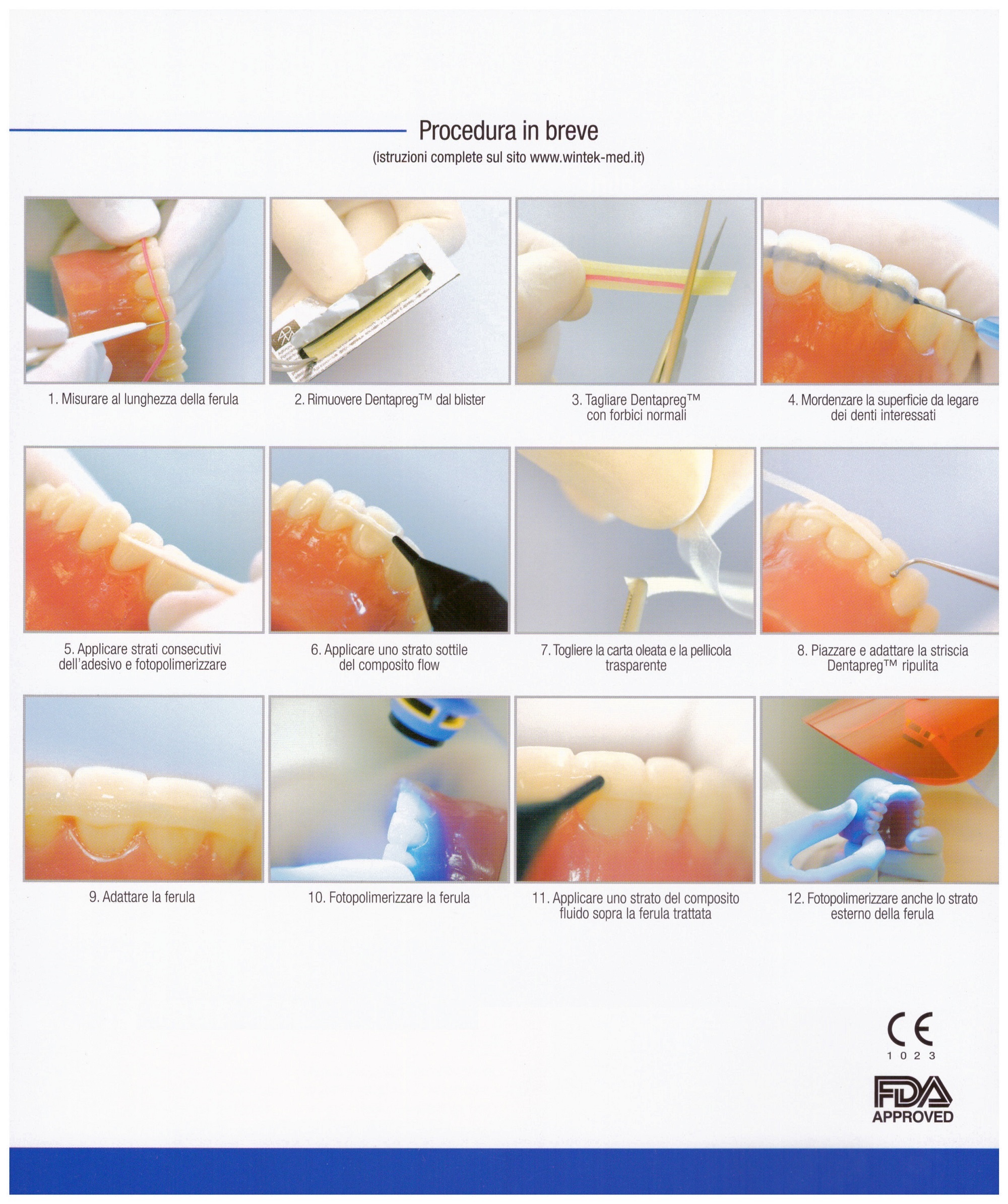 Dentapreg Splint 4